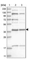 KTI12 Chromatin Associated Homolog antibody, PA5-56670, Invitrogen Antibodies, Western Blot image 