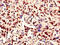 RNA Binding Motif Protein 10 antibody, A63294-100, Epigentek, Immunohistochemistry paraffin image 