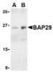 B Cell Receptor Associated Protein 29 antibody, TA306280, Origene, Western Blot image 