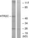 5-Hydroxytryptamine Receptor 2C antibody, LS-C120545, Lifespan Biosciences, Western Blot image 