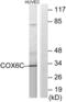 Cytochrome C Oxidase Subunit 6C antibody, abx013972, Abbexa, Western Blot image 