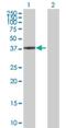 SPO11 Initiator Of Meiotic Double Stranded Breaks antibody, H00023626-B01P, Novus Biologicals, Western Blot image 