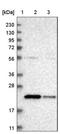 Diamine acetyltransferase 2 antibody, NBP1-80722, Novus Biologicals, Western Blot image 