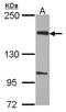 EvC Ciliary Complex Subunit 2 antibody, NBP1-31268, Novus Biologicals, Western Blot image 