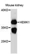 HemK Methyltransferase Family Member 1 antibody, STJ114525, St John