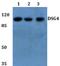 Desmoglein-4 antibody, A08348, Boster Biological Technology, Western Blot image 
