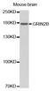 NMDAR2B antibody, LS-C332343, Lifespan Biosciences, Western Blot image 