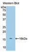 Bone Morphogenetic Protein 5 antibody, LS-C300094, Lifespan Biosciences, Western Blot image 