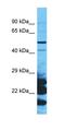 Family With Sequence Similarity 184 Member A antibody, orb326993, Biorbyt, Western Blot image 