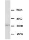 WD Repeat Domain 83 antibody, PA1053, Boster Biological Technology, Western Blot image 