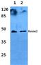 HEXIM P-TEFb Complex Subunit 2 antibody, A09854, Boster Biological Technology, Western Blot image 