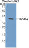 PLA2-R antibody, LS-C295908, Lifespan Biosciences, Western Blot image 