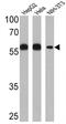 Prolyl 4-Hydroxylase Subunit Beta antibody, GTX25484, GeneTex, Western Blot image 