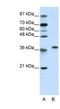 Ribosomal Protein L6 antibody, NBP1-57526, Novus Biologicals, Western Blot image 