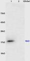 Cancer/testis antigen 1 antibody, GTX51601, GeneTex, Western Blot image 
