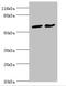 PDZ Domain Containing 3 antibody, orb33940, Biorbyt, Western Blot image 