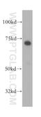 Rhophilin Rho GTPase Binding Protein 1 antibody, 13460-1-AP, Proteintech Group, Western Blot image 
