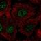Chromosome 17 Open Reading Frame 50 antibody, PA5-65351, Invitrogen Antibodies, Immunofluorescence image 
