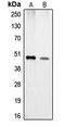Carboxypeptidase A1 antibody, LS-B15543, Lifespan Biosciences, Western Blot image 