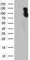 Dipeptidyl Peptidase 9 antibody, TA504304, Origene, Western Blot image 