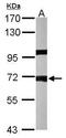 Protein Phosphatase 1 Regulatory Subunit 16A antibody, TA307967, Origene, Western Blot image 