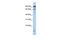 Male-specific lethal 2 homolog antibody, GTX46913, GeneTex, Western Blot image 