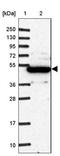 Neuropilin 2 antibody, NBP1-86866, Novus Biologicals, Western Blot image 