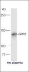 Solute Carrier Family 2 Member 2 antibody, orb183810, Biorbyt, Western Blot image 