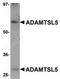 ADAMTS Like 5 antibody, TA306960, Origene, Western Blot image 