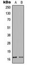 Calmodulin antibody, LS-C354566, Lifespan Biosciences, Western Blot image 