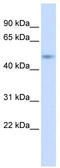 Zinc finger and BTB domain-containing protein 44 antibody, TA339465, Origene, Western Blot image 