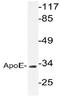 Apolipoprotein E antibody, AP20663PU-N, Origene, Western Blot image 