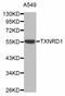 Thioredoxin Reductase 1 antibody, abx003083, Abbexa, Western Blot image 