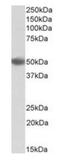 CD209 Molecule antibody, orb318734, Biorbyt, Western Blot image 