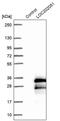 Spermatogenesis Associated 24 antibody, PA5-60578, Invitrogen Antibodies, Western Blot image 