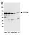 Serine/threonine-protein phosphatase 2B catalytic subunit alpha isoform antibody, A300-908A, Bethyl Labs, Western Blot image 