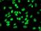 Retinol Binding Protein 1 antibody, NBP2-00637, Novus Biologicals, Immunocytochemistry image 