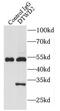 DTW Domain Containing 2 antibody, FNab02552, FineTest, Immunoprecipitation image 