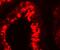 Y-Box Binding Protein 2 antibody, GTX85161, GeneTex, Immunohistochemistry paraffin image 