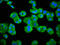 G Protein-Coupled Receptor Kinase 3 antibody, CSB-PA001395LA01HU, Cusabio, Immunofluorescence image 