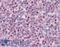 Zinc Finger And BTB Domain Containing 1 antibody, LS-B9396, Lifespan Biosciences, Immunohistochemistry paraffin image 