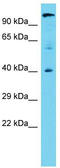Chromosome 11 Open Reading Frame 49 antibody, TA330730, Origene, Western Blot image 