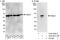 26S protease regulatory subunit 4 antibody, A303-821A, Bethyl Labs, Immunoprecipitation image 