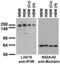 Inositol 1,4,5-Trisphosphate Receptor Type 1 antibody, 73-035, Antibodies Incorporated, Western Blot image 