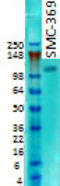 Discs Large MAGUK Scaffold Protein 1 antibody, TA326524, Origene, Western Blot image 