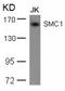 Structural Maintenance Of Chromosomes 1A antibody, 79-356, ProSci, Western Blot image 