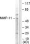 Minichromosome Maintenance Complex Component 5 antibody, TA312326, Origene, Western Blot image 