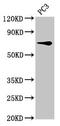 Sodium Channel Epithelial 1 Beta Subunit antibody, CSB-PA020849LA01HU, Cusabio, Western Blot image 