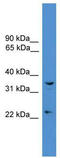 Ubiquitin C-Terminal Hydrolase L5 antibody, TA342562, Origene, Western Blot image 