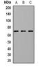 Cholesteryl Ester Transfer Protein antibody, orb411991, Biorbyt, Western Blot image 